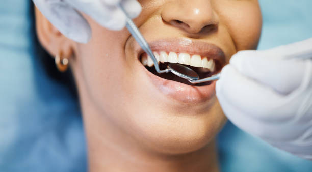 Best Walk-In Emergency Dental Services in Standish, MI
